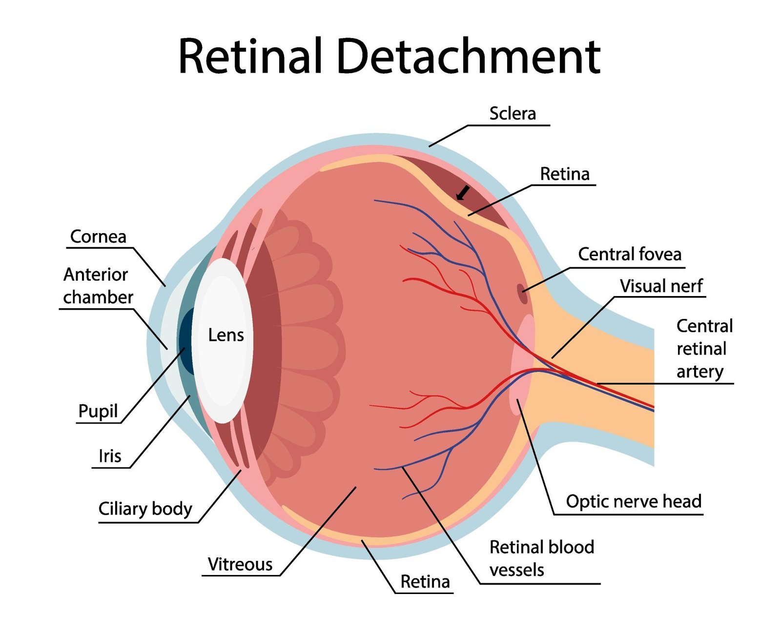 Retina-Treatment